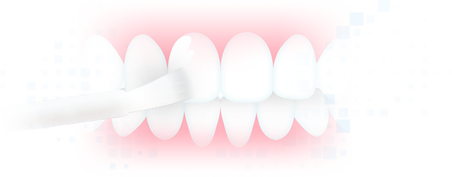 ブラシでホワイトニングジェルを歯に直接塗るから、歯並びが悪い方でもむらなくホワイトニング可能